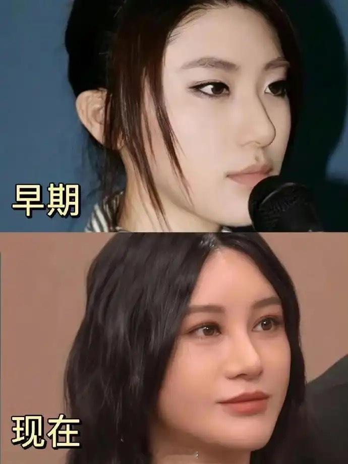 尚雯婕早期好有姬感，为啥想不开要去微调啊
