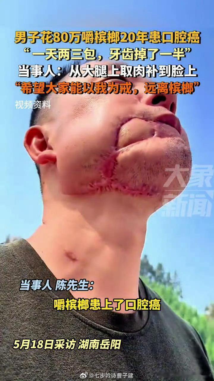 我去HN出差，出租车司机（网约车司机）都在吃这个槟榔，我还纳闷怎么上车有股怪味下