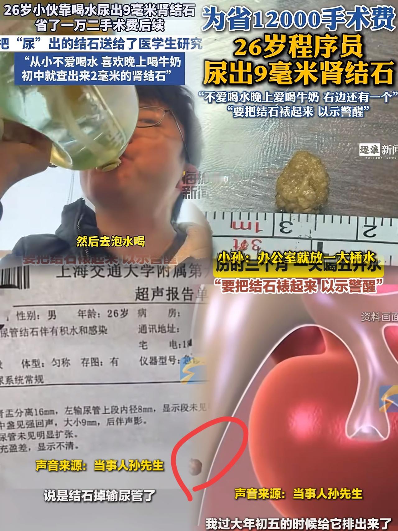 见过狠的，没见过这么狠的！山东一26岁小伙为省一万多手术费开启“疯狂排石”模