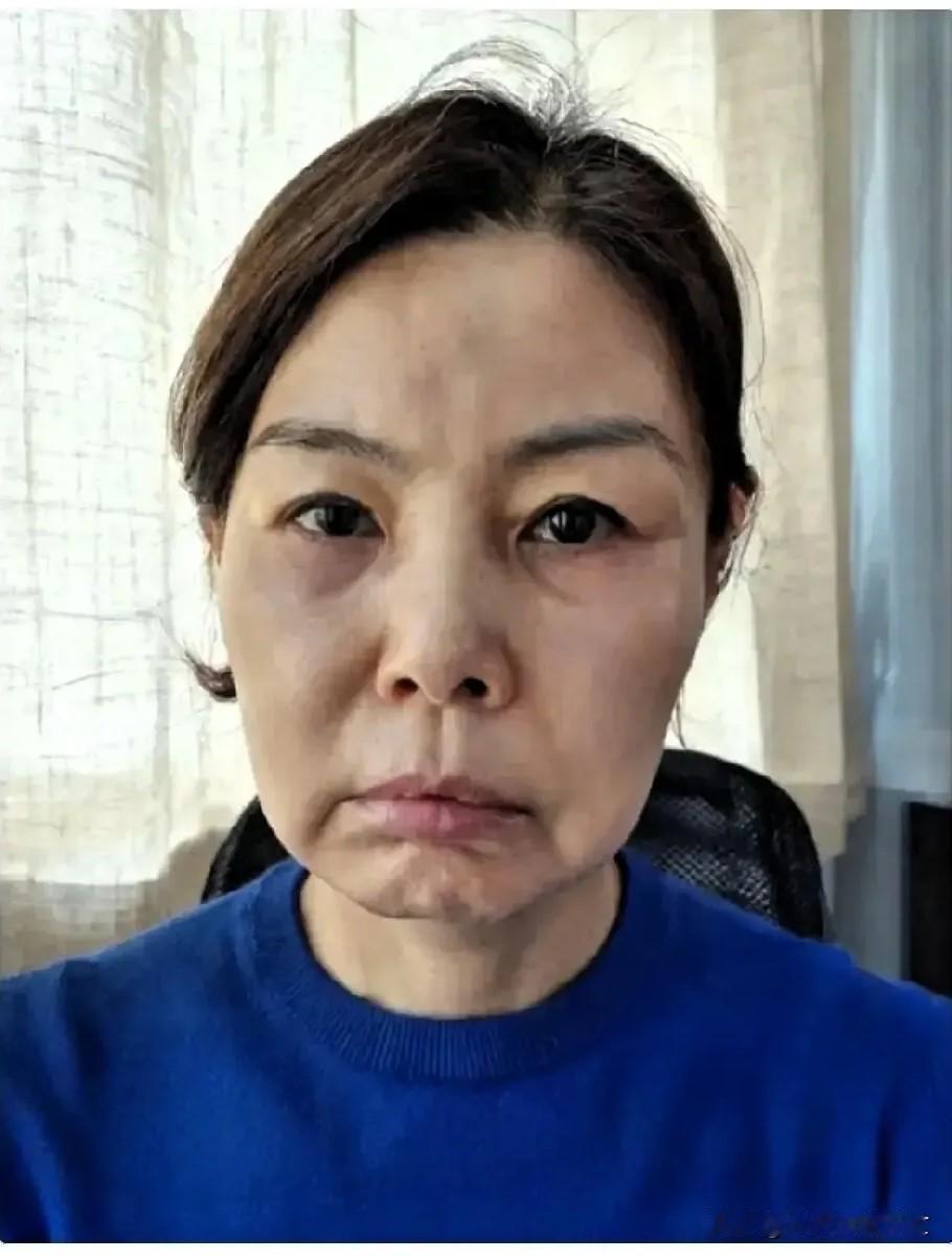 女人千万不要过度存钱？去医院看望个同事，直接把我干无语了。47岁，月薪六