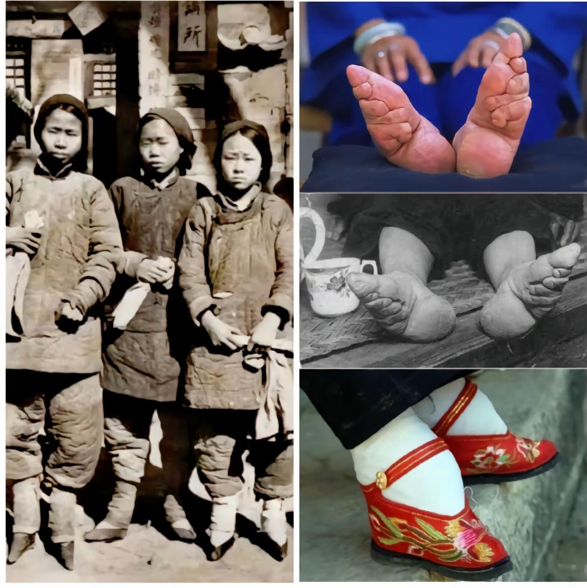 “小脚一双，眼泪一缸”是缠足的真相！晚清时期三名缠足女青年的照片，给人们留下了