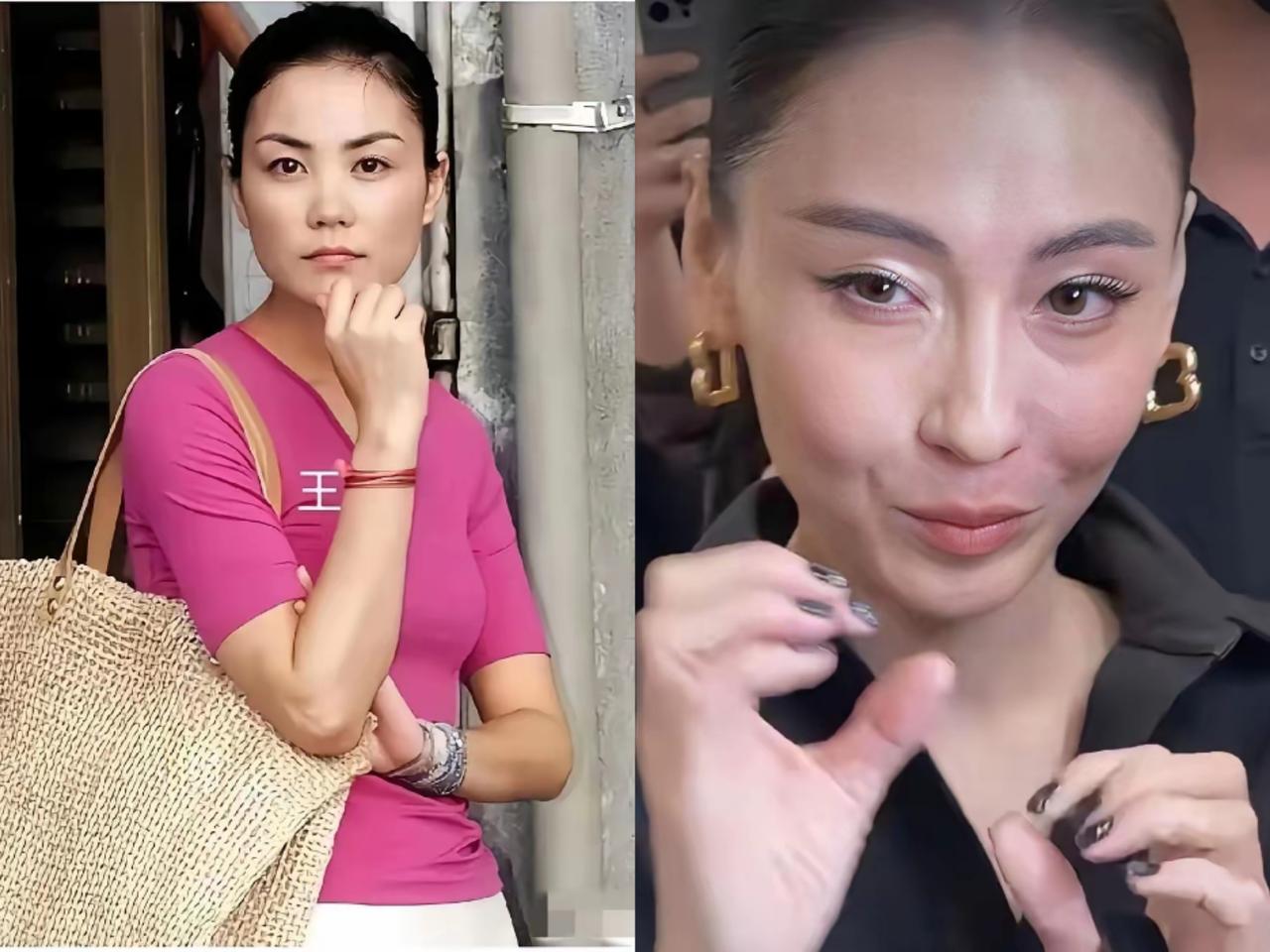 明眼人都看出来，张柏芝的变化好大，不是医美严重，而是医美后期的脸型已经不再是