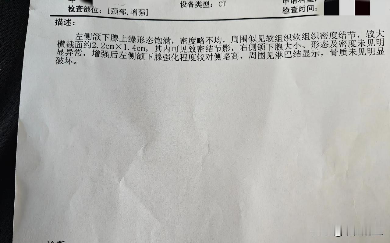 现在有的医生真的不如DeepSeek了！明明是结石，然后他非得说有可能是肿瘤，最