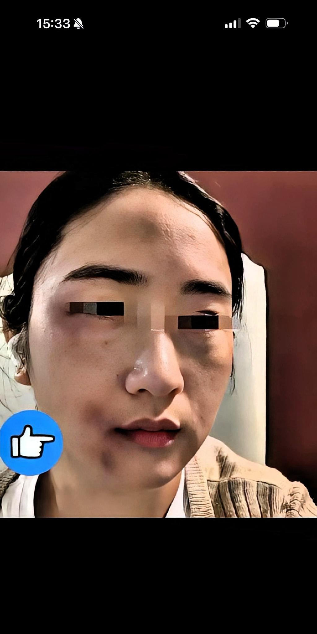 女子遭丈夫殴打后，弟弟得知情况，拿起家中的一根钢管赶到姐姐家。丈夫开门后，弟弟没
