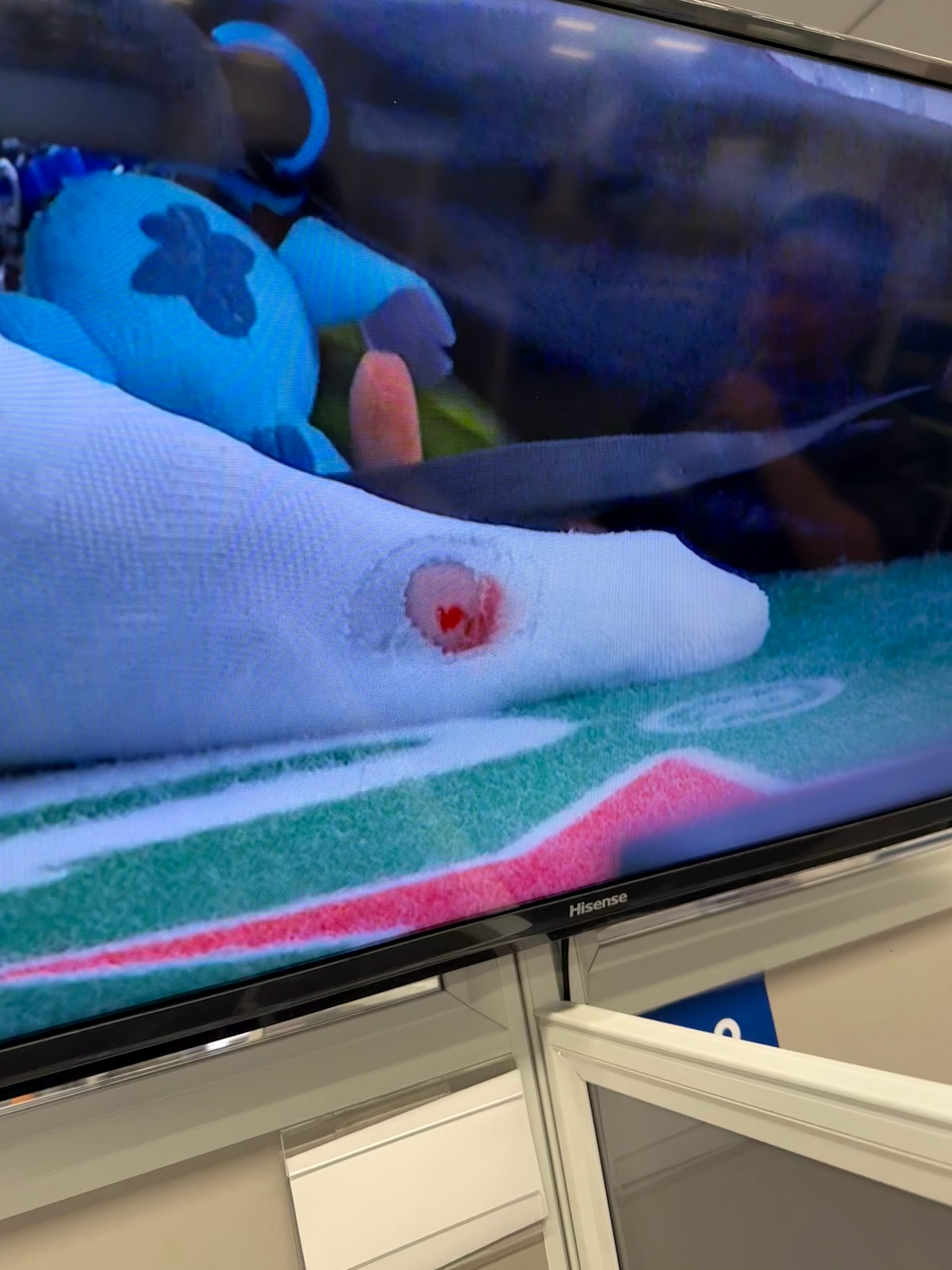 奖金不好赚啊，瓦舍罗的脚已经这样了，刚刚没包扎直接穿上了鞋了？？？[？？？]网球t