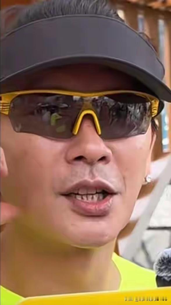 黄宗泽的牙齿变成这样，应该与他长期吸烟有关系！可以看到他的牙齿不仅有牙龈萎缩，牙