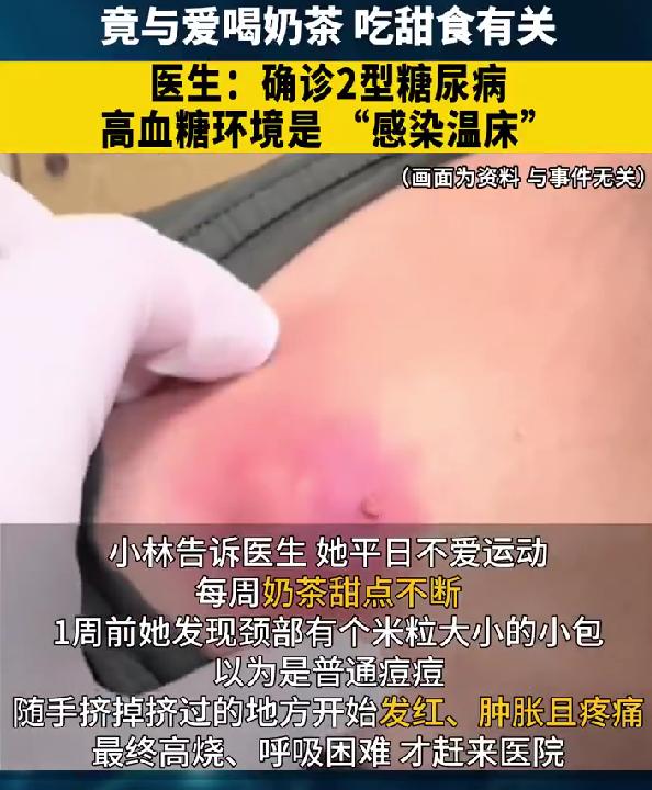 女子挤1颗痘痘，1周后高烧40度，竟确诊糖尿病！最近刷到一个吓人的新闻，27岁