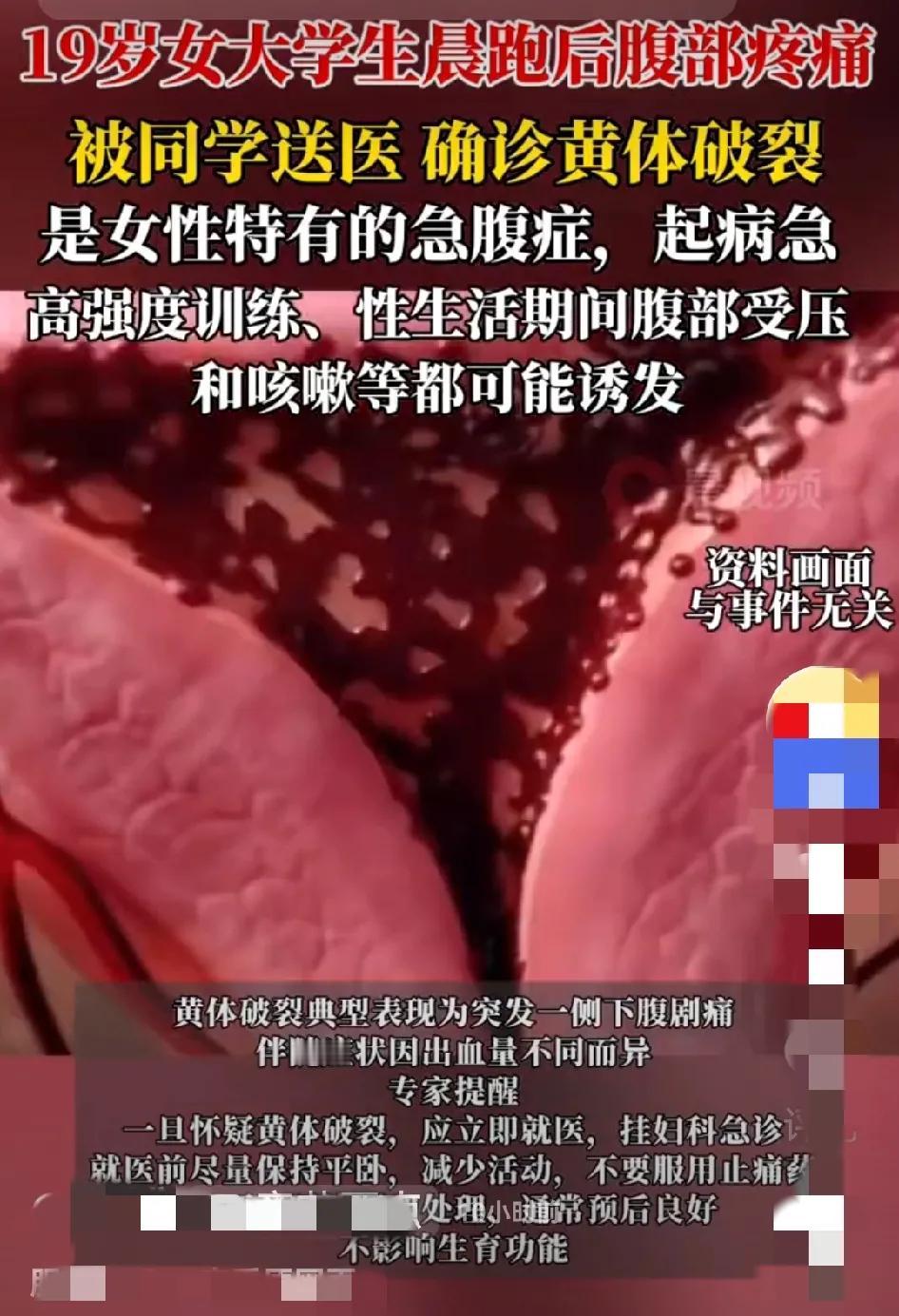 不要贪欢！年轻体力强，力量大，有激情，但要互谅互爱，有节制合理休息！不然，就容易