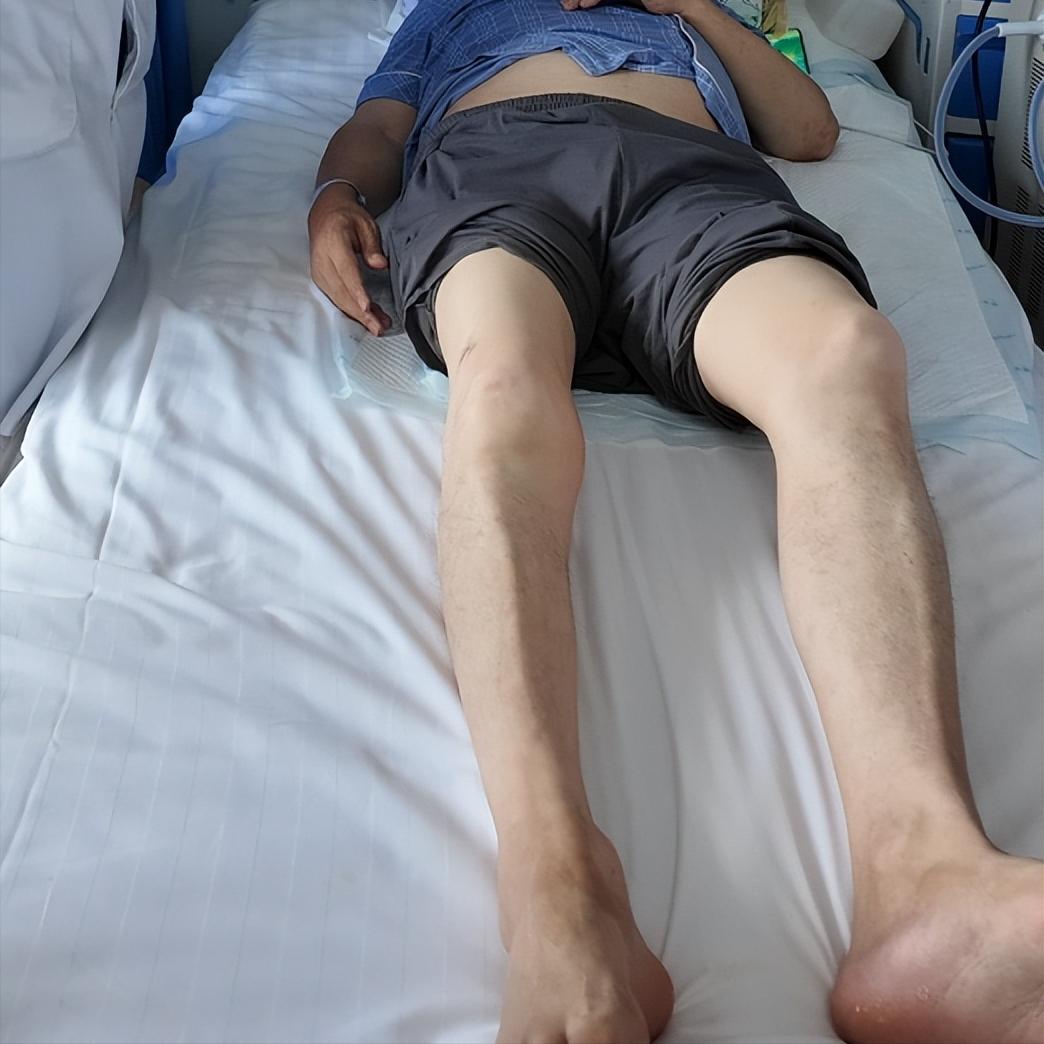 偏瘫，为什么都讲究：能坐不躺，能站不坐为什么不能躺？长期卧床，肌肉以惊人的