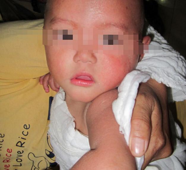 奶奶常常这样做, 致使6岁孙子患上肾衰竭, 医生怒斥孩子孩子奶奶无知