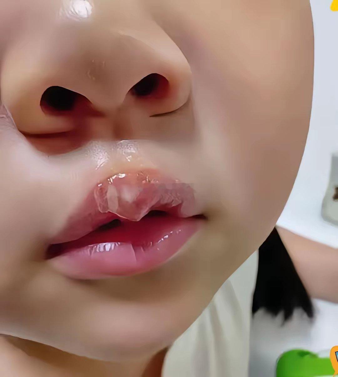 这个幼儿园的女老师还是人吗？用高达180度的热熔枪的这个胶水来烫孩子的嘴巴理由就