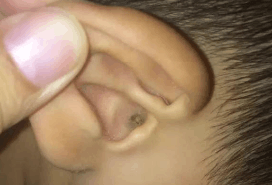 孩子身体里的这些东西不要清除干净, 有抵抗细菌的“作用”