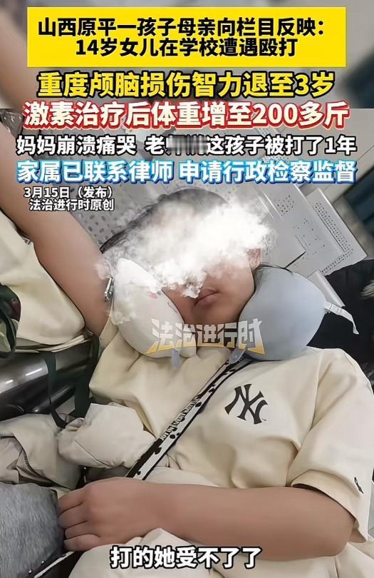 山西原平，女子给女儿洗澡时，发现女儿身上青一块紫一块，因问女儿怎么回事儿，见女儿