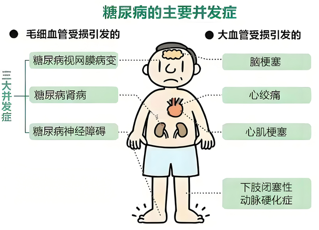 这3种糖尿病并发症最难治, 要早防治, 专家教你预防措施!