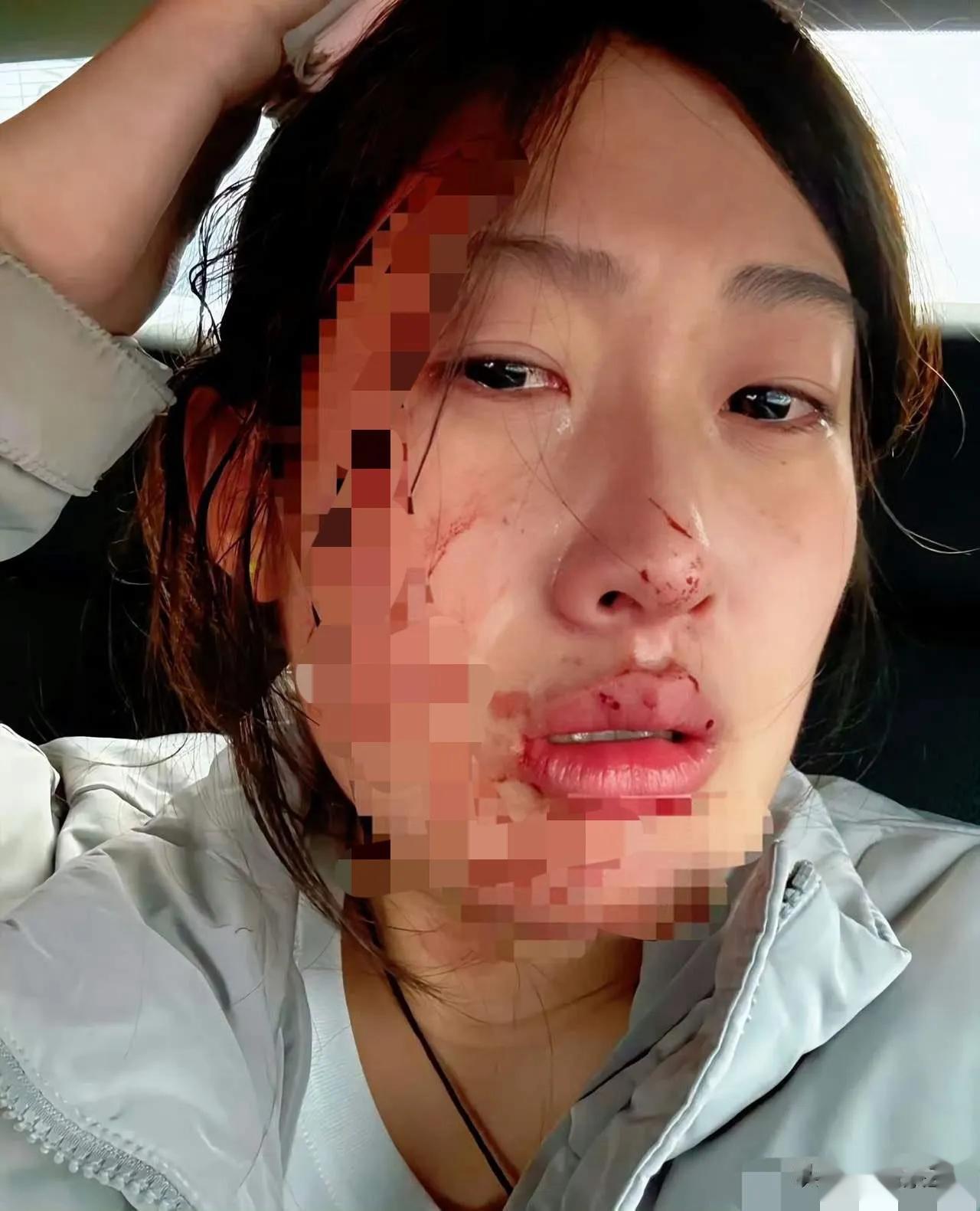 知道你心疼孩子，可是人家护士也是一位孩子啊。事发河北的秦皇岛，一23岁的护士给