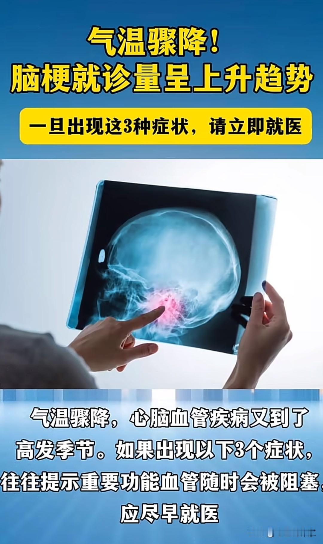 气温骤降，预防脑梗！最近气温骤降，心脑血管疾病又到了高发季节，一旦出现这三种