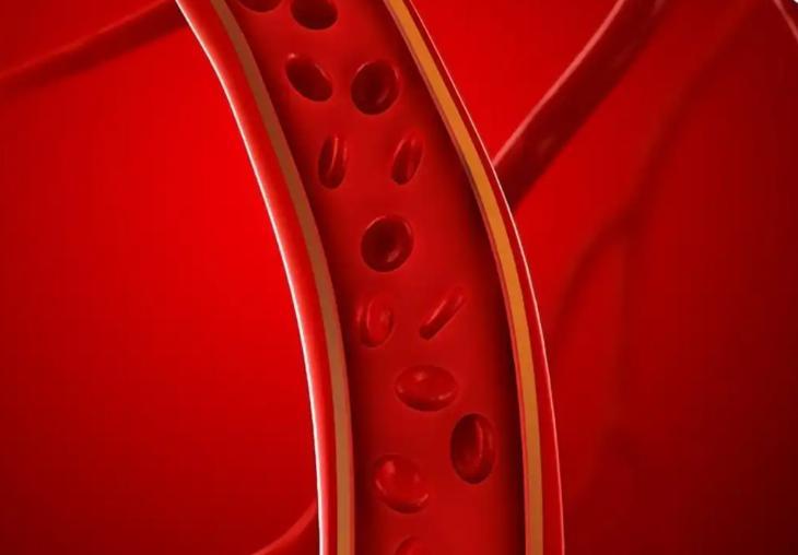 脑梗谨记，早晨1大忌，中午2不要，晚上3不做脑梗应该都不陌生，有一个特别让神