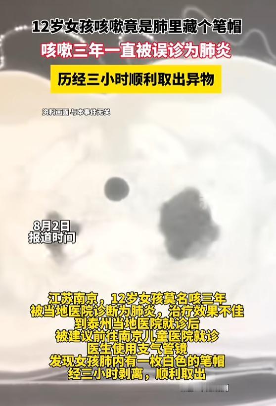 “太震惊了！”8月2日报道，江苏，一12岁女孩莫名其妙咳嗽3年，去医院时被诊断为
