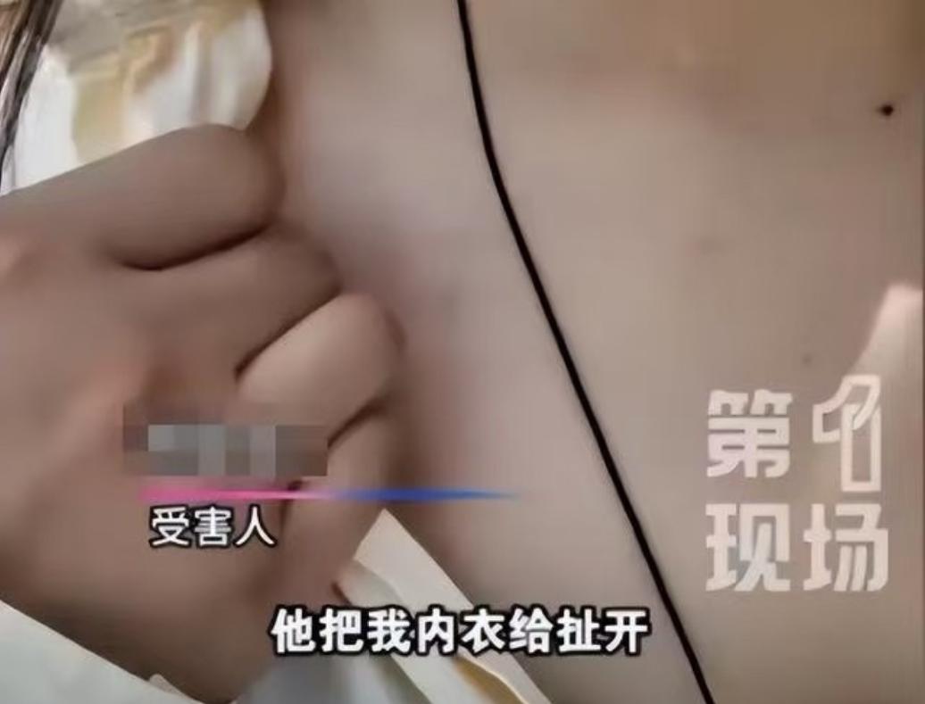 马鞍山，女子在诊所，碰到了给自己治疗乳房结节的医生，对方二话不说，直接扯开了她的