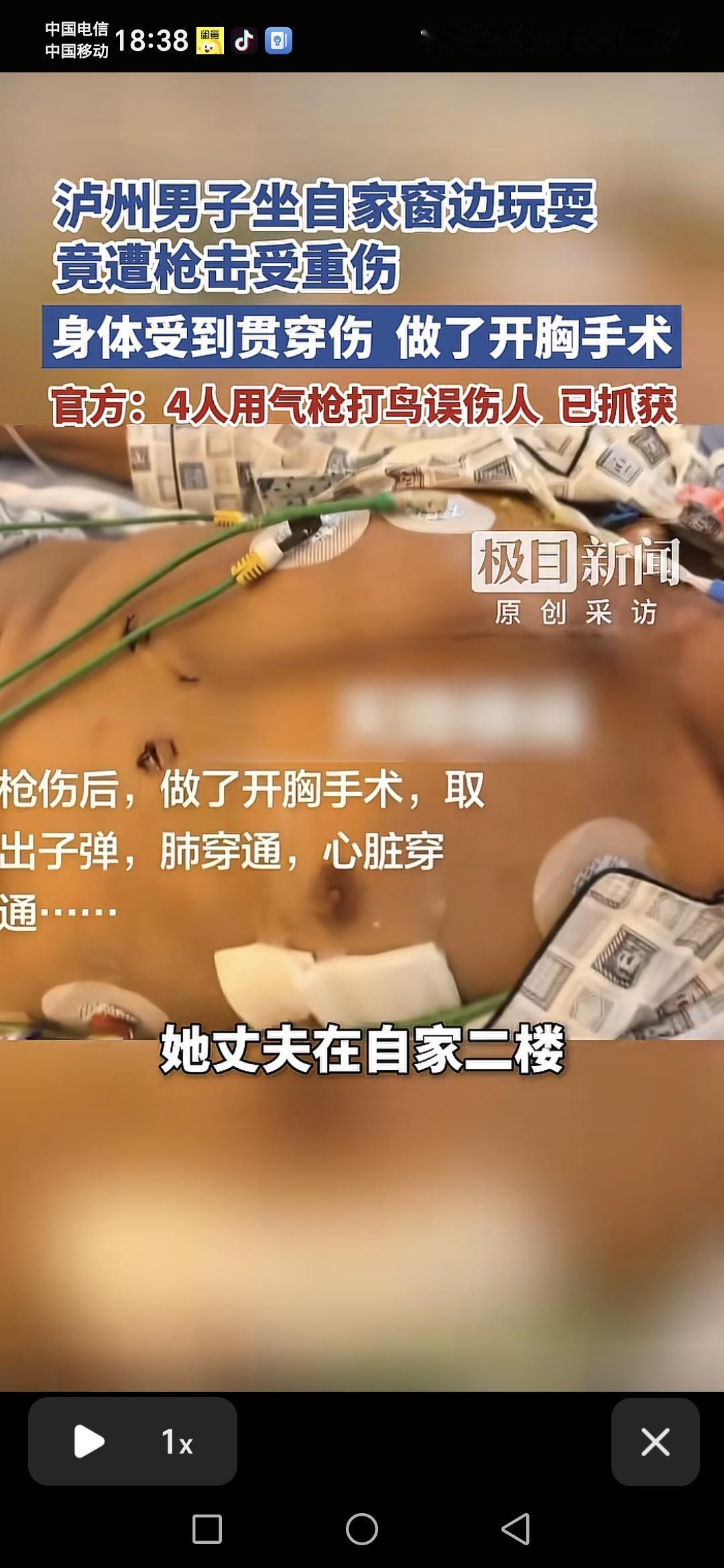 四川泸州一男子坐在家中窗户边玩耍时，突然遭到枪击。身体上受到贯穿伤，送往医院做开