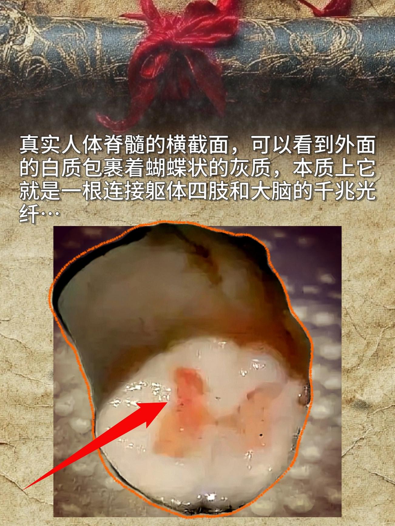 真实人体脊髓的横截面，可以看到外面的白质包裹着蝴蝶状的灰质，本质上它就...