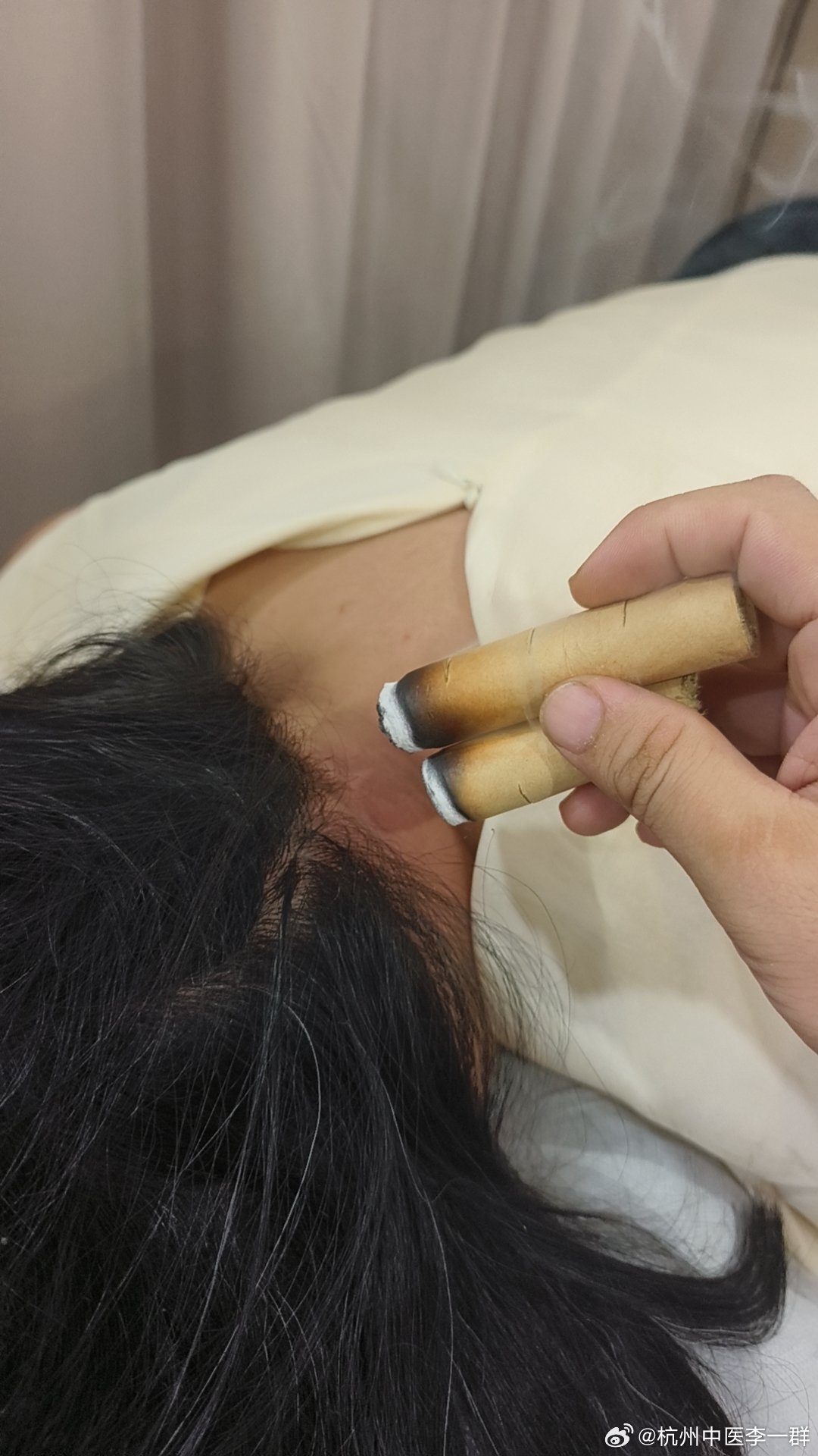 埋线，针灸，开药，腰腹灸又是忙碌的下午门诊针灸中医养生养生中医杭州