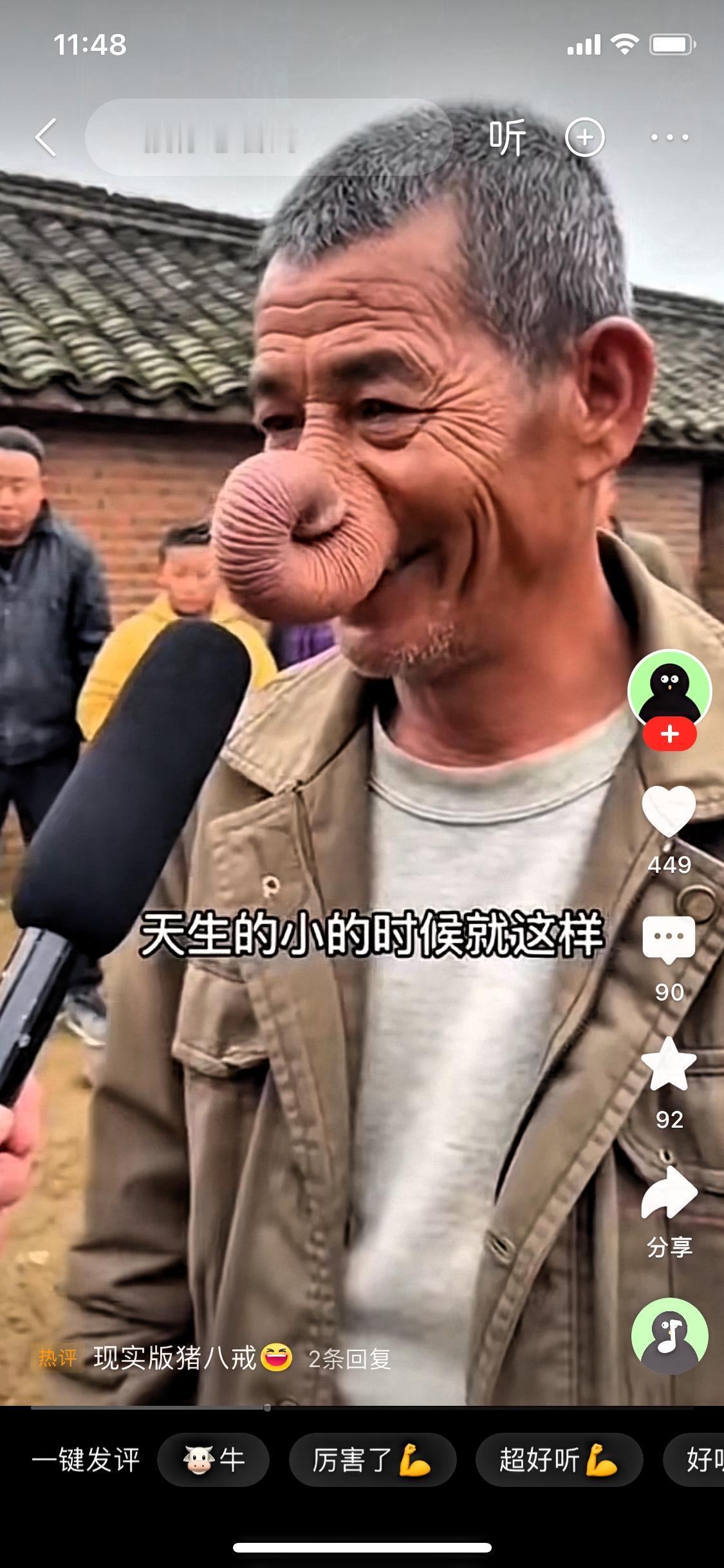 这鼻子一出来，我手机都差点拿不稳！你见过长着大象同款长鼻的人吗？采访镜头怼过