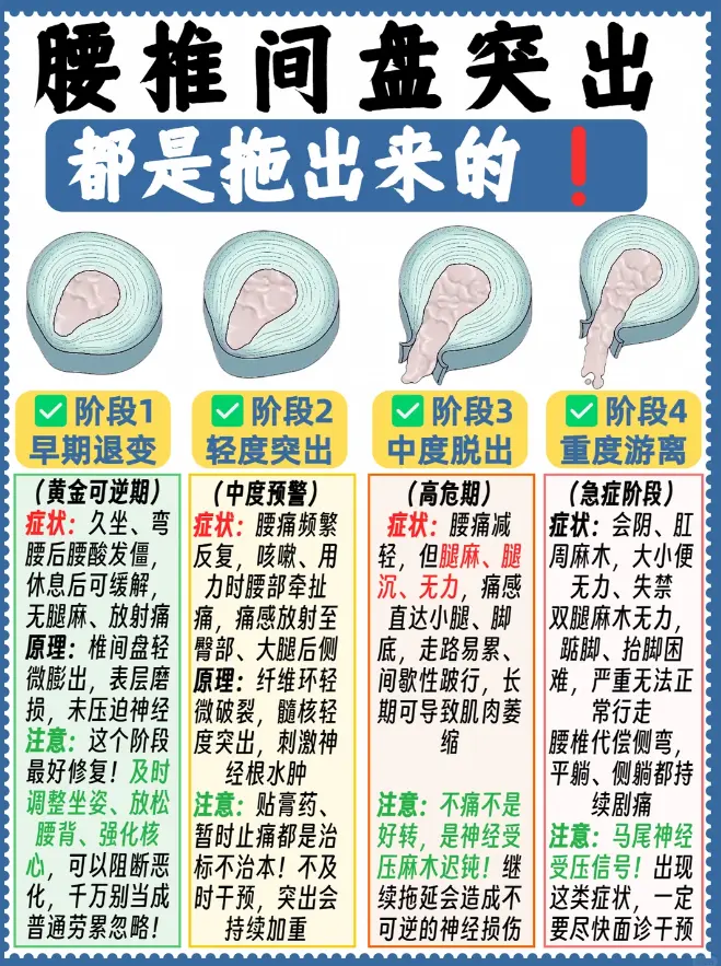 腰突都是拖出来的✨骨科医生教你分阶段自查 大部分腰突都是日积月累拖出来...