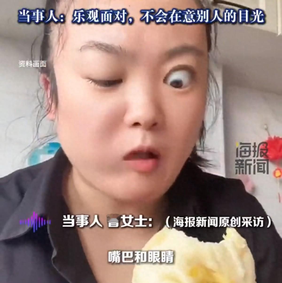 女子吃东西秒变大小眼遭网友调侃，当事人：嘴巴和眼睛天生有一个神经串联，不影响生活