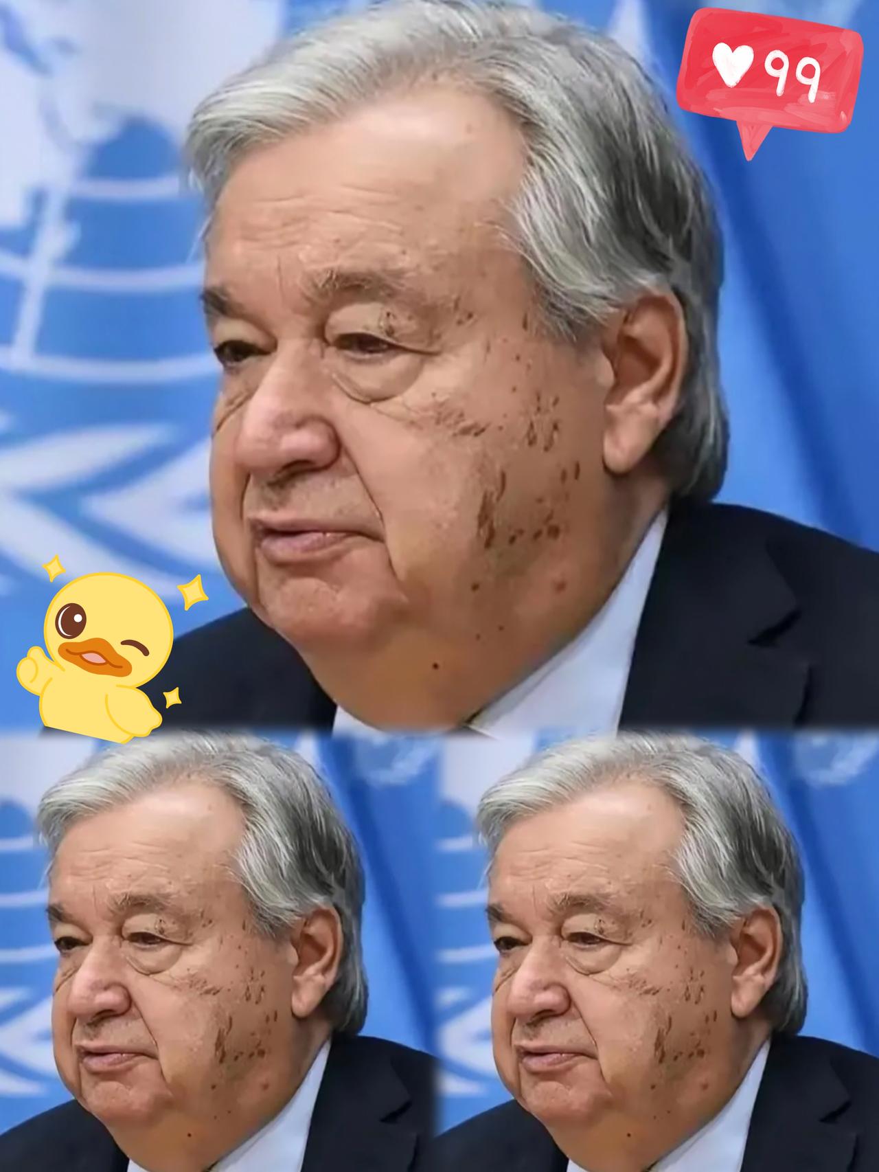 秘书长古特雷斯官宣：二战爆发源头是日本侵华，颠覆西方百年偏见，全球舆论炸锅。