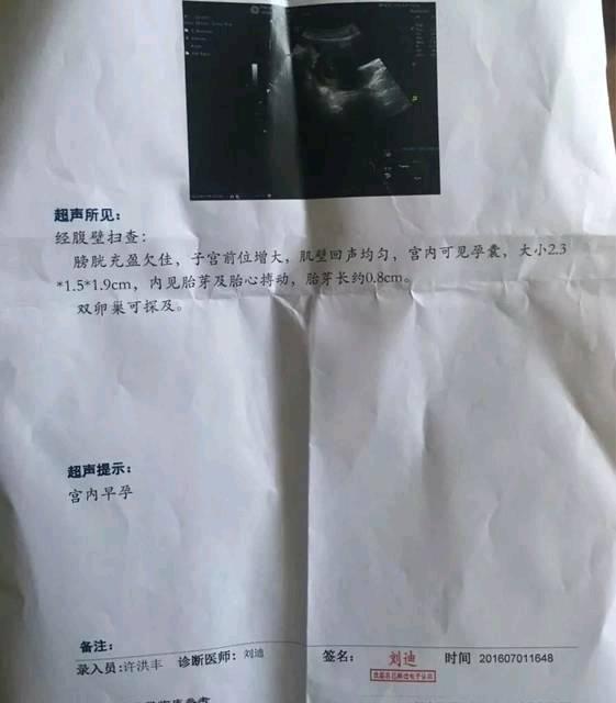 总结老大儿子所有症状, 网上所谓看男女, 附图