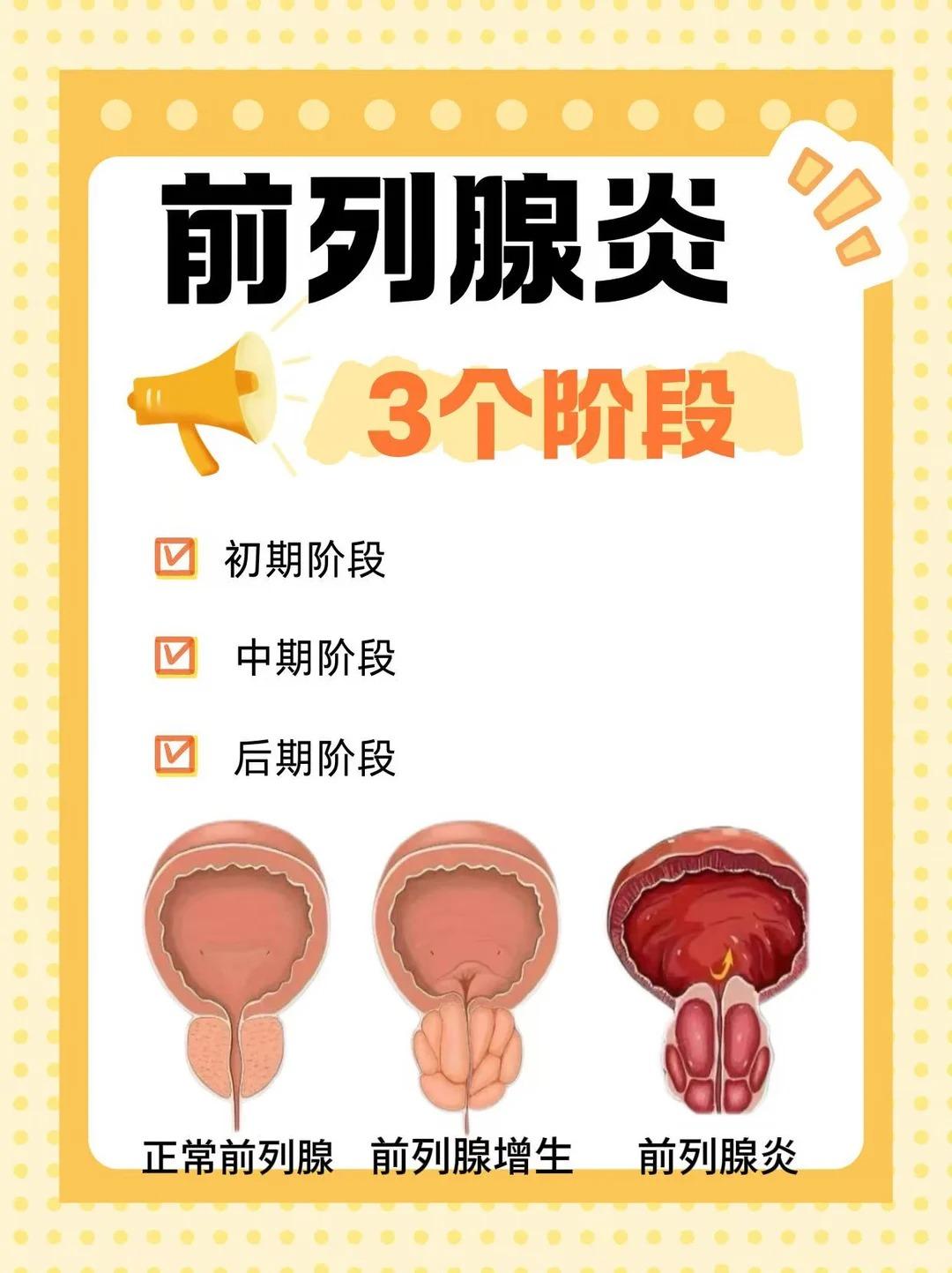读懂前列腺炎的三个阶段，避免病情持续加重