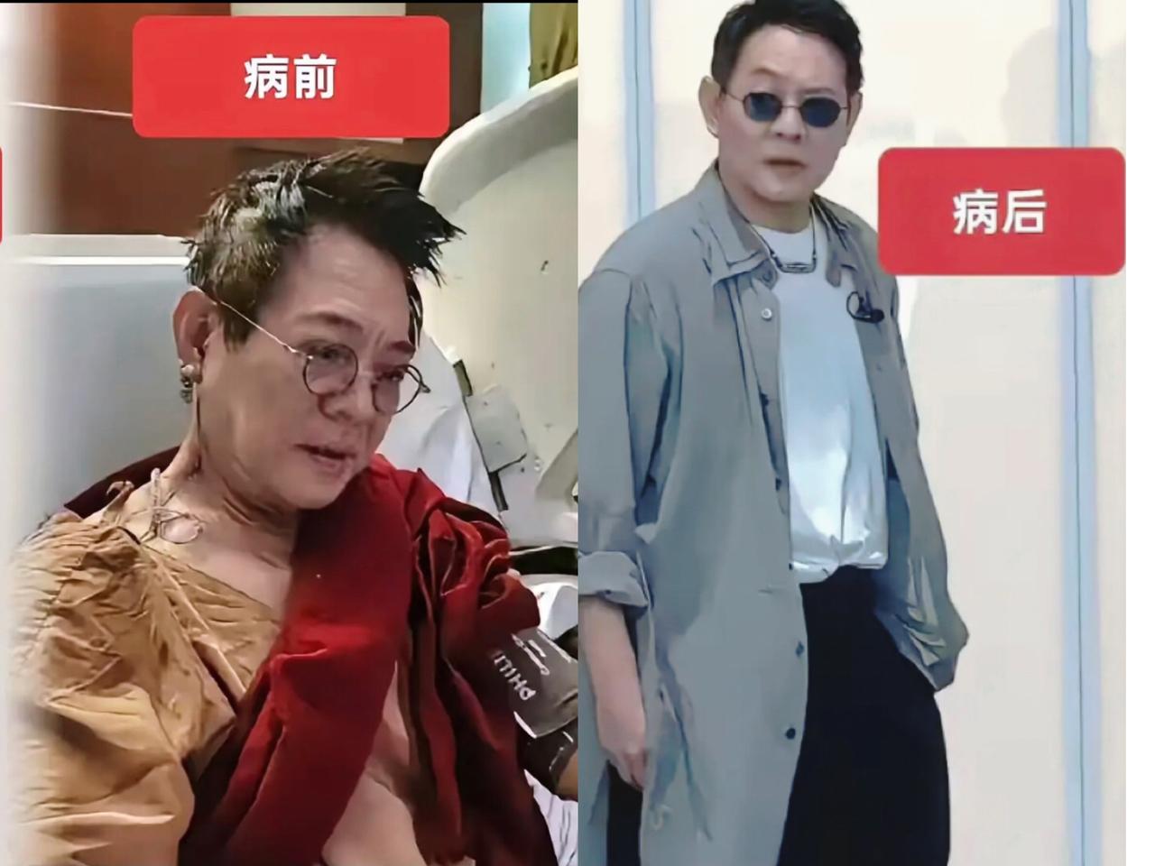 还在吵“李连杰回国是中医赢了西医”？醒醒吧！人家甲亢发作时靠西医吃药稳住指