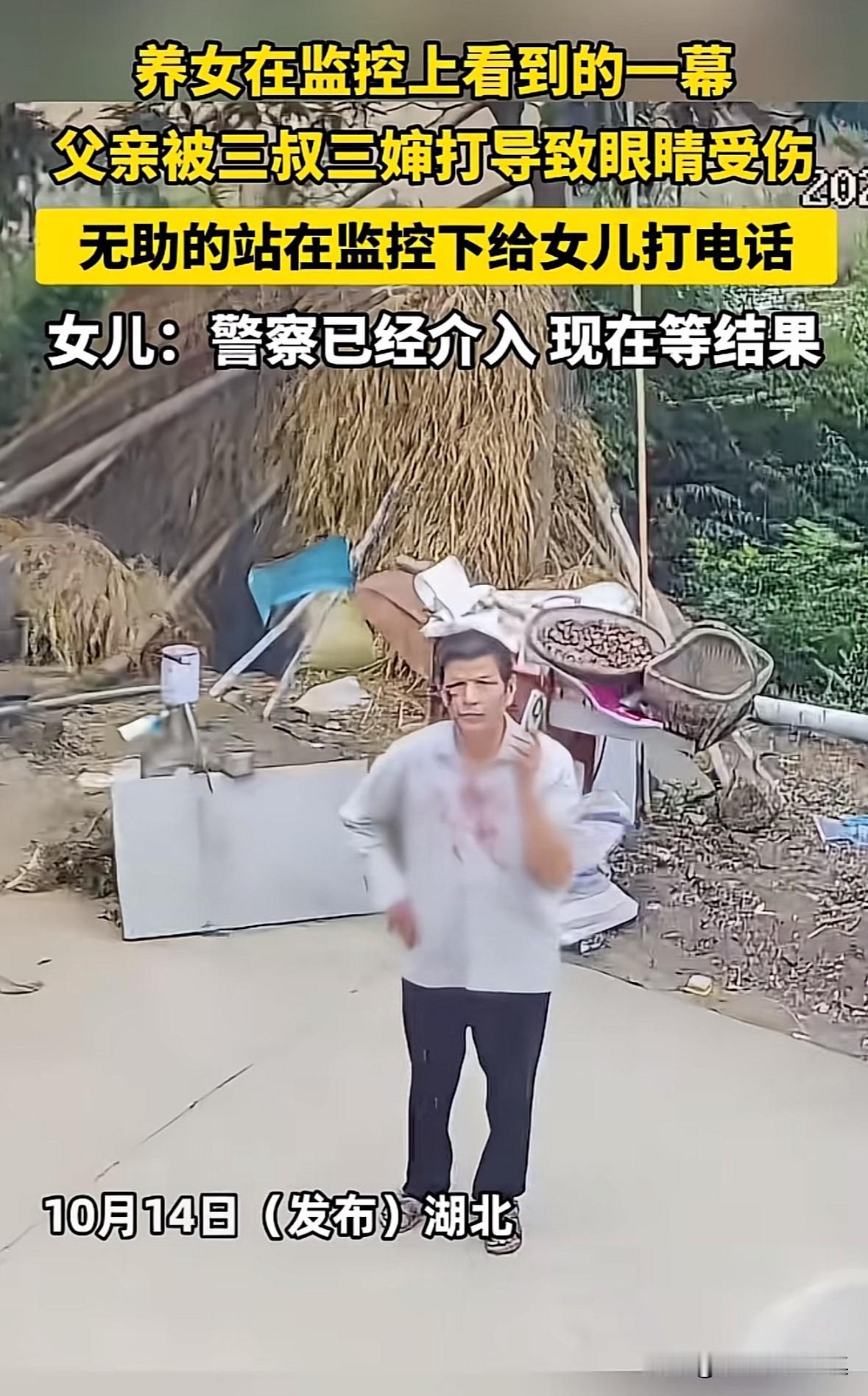 湖北一位父亲被自己的弟弟和弟媳打伤，眼角缝了九针。这位父亲被打后，无助的站在摄
