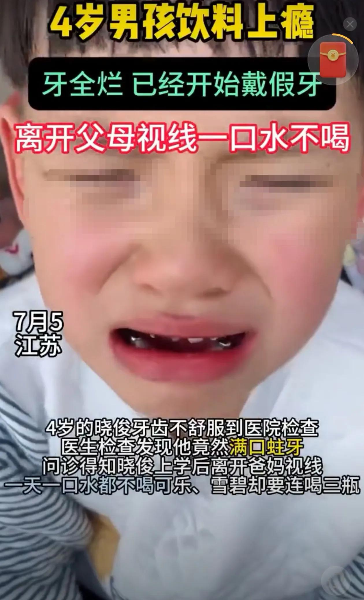 4岁男孩饮料上瘾,牙全烂，已经开始戴假牙，离开父母视线一口水不喝，都是家长惯的，