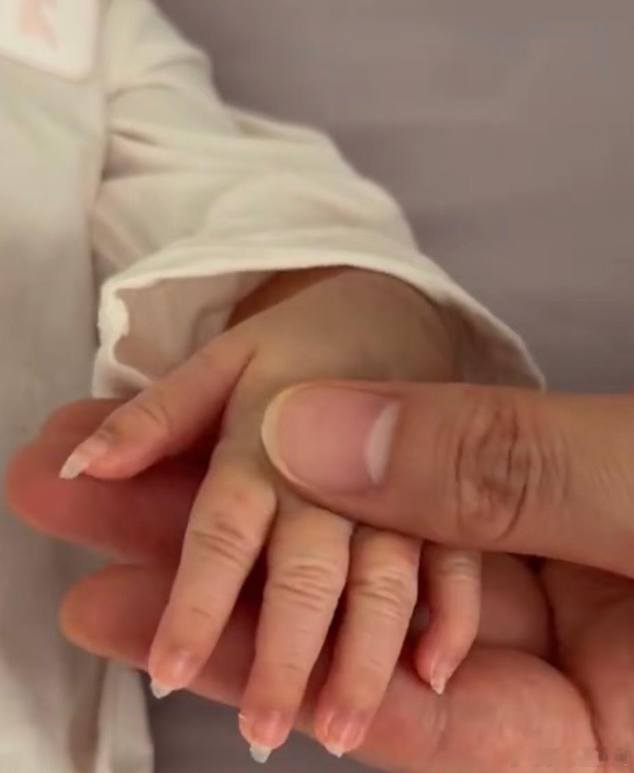 1.宝宝刚离开羊水保护，皮肤容易干燥起皮，前几天要勤涂面霜做好保湿2.新生儿