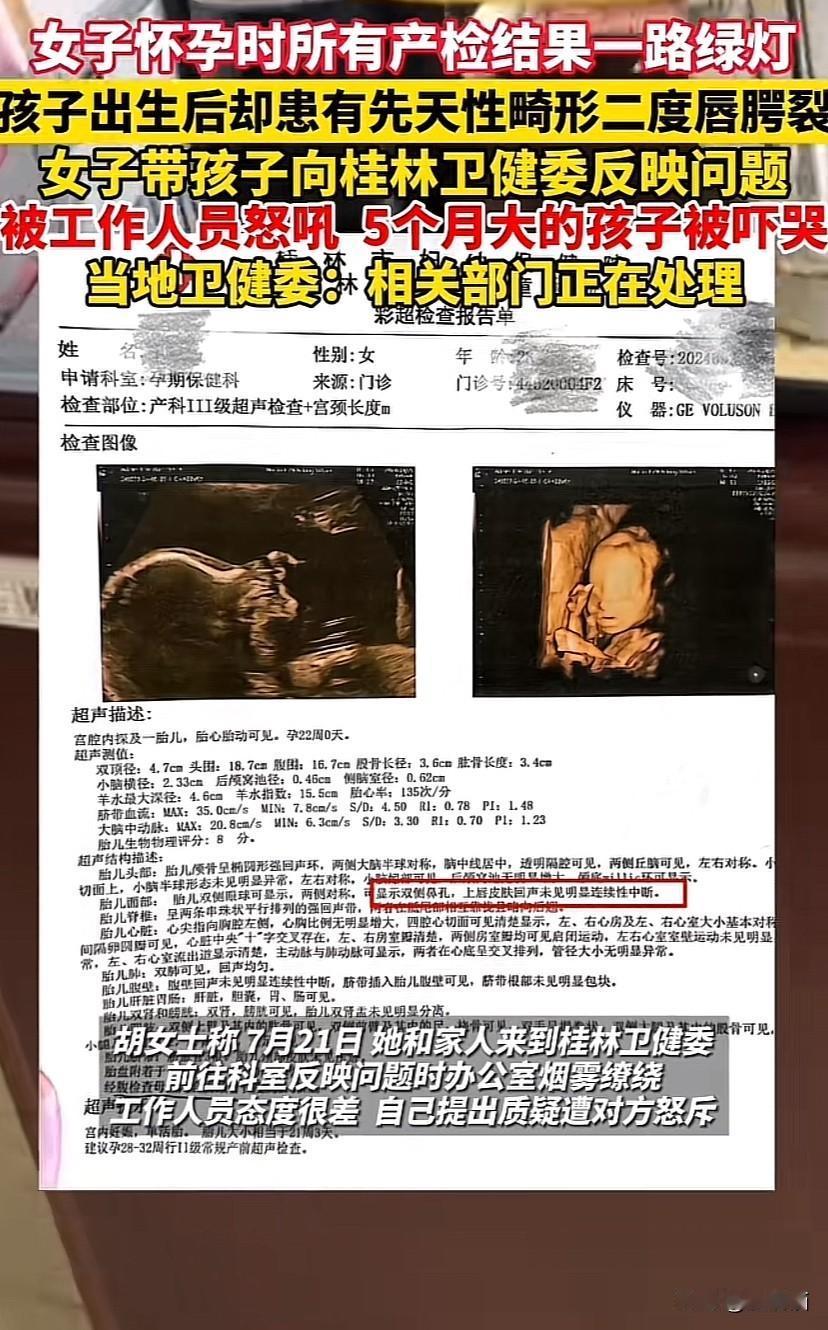 广西桂林，女子怀孕时产检结果一路绿灯，孩子生下来后却有先天性畸形，女子带着孩子向
