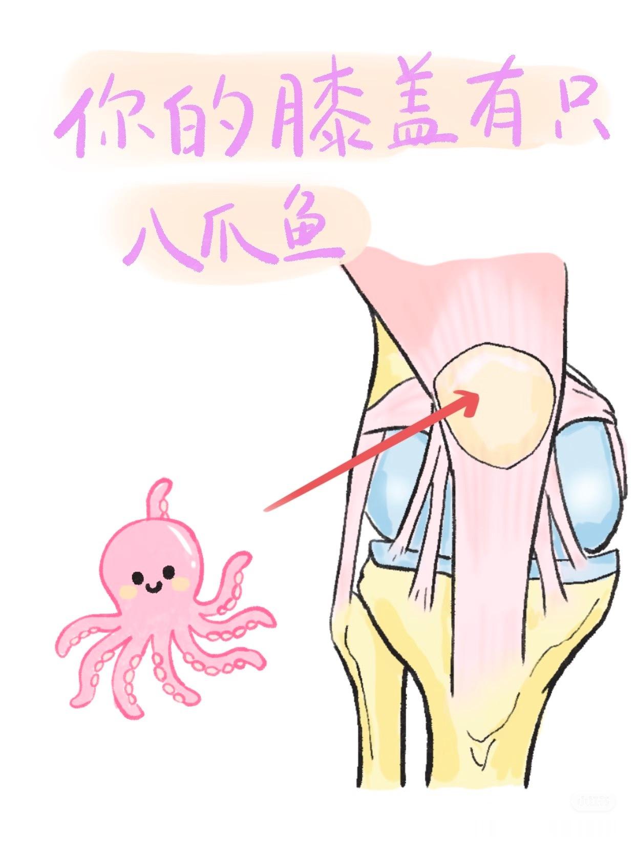 膝关节损伤继续来认识膝关节——髌骨周围韧带✅髌韧带连接髌骨下极与胫骨结节，是将