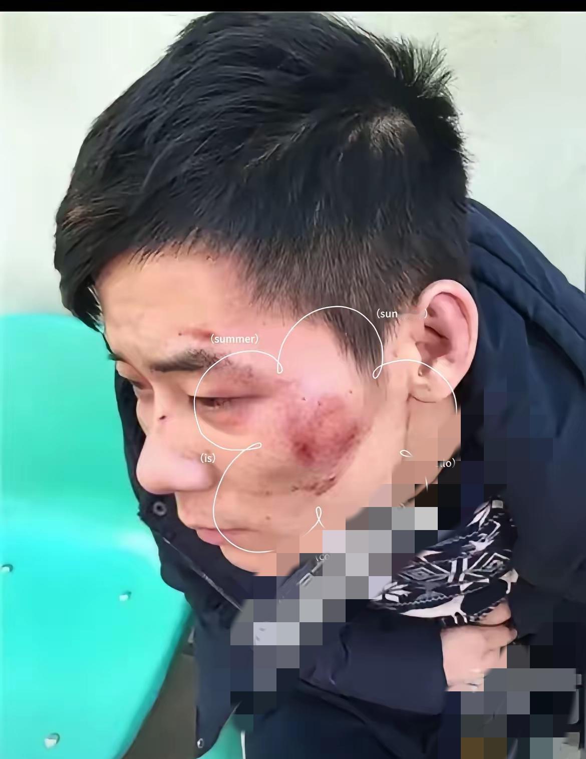 真的太聪明了！这男子大半夜被人追打，第一时间直奔武警营门，堪称绝境求生的最优解，
