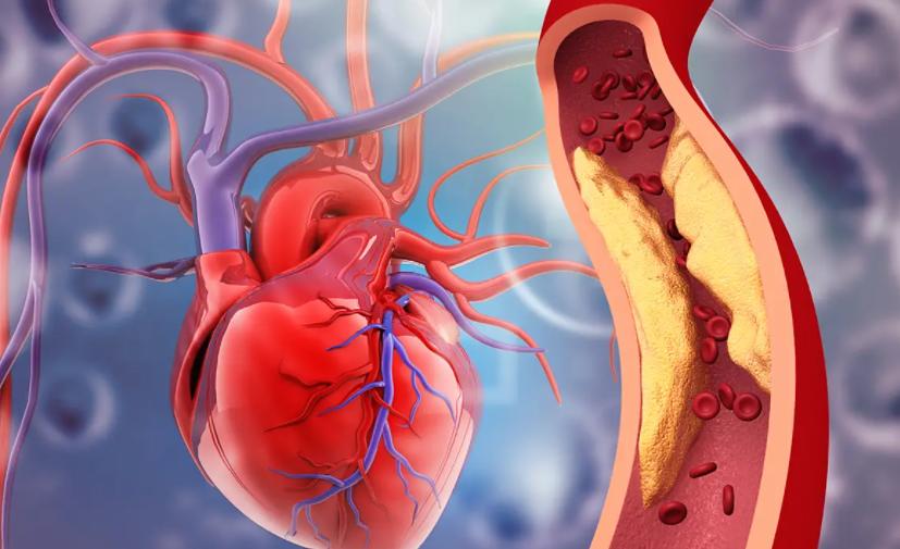 为什么节日期间心血管最爱“闹脾气”节日期间心血管确实爱“闹脾气”。就像春节时，