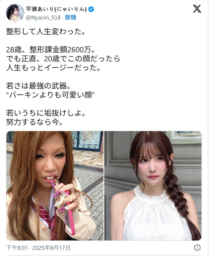 日本28岁女士，斥资高达2600万日元（约人民币128万元）进行多次整形手术，彻