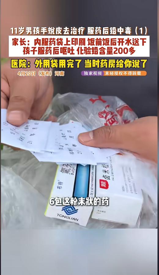“这也太儿戏了！”近日，河南，一男孩因为手蜕皮去医院治疗，医生给开了药。原本是外