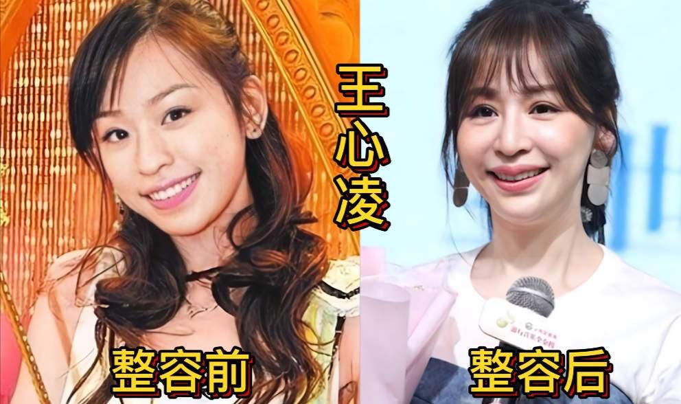 微调过的三位女明星，王心凌、薛佳凝和秦海璐，有的越来越精致好看，有的却脸部僵硬，