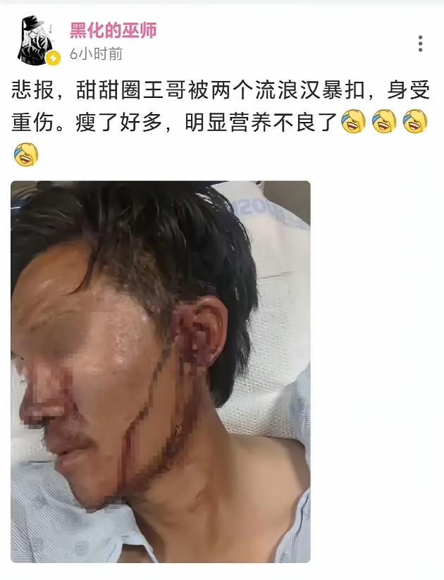 这是甜甜圈？怎么瘦成这个样子了？