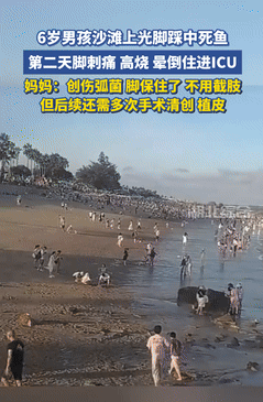 悲剧还是发生了！福建厦门，一男孩去沙滩玩耍时，不慎被死鱼给扎到了，谁料，第二天竟