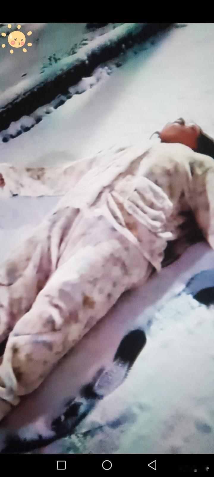 痛心“太快了”妻子下雪出去溜达玩突然不小心后脑勺着地当时摔的人不会吭声了