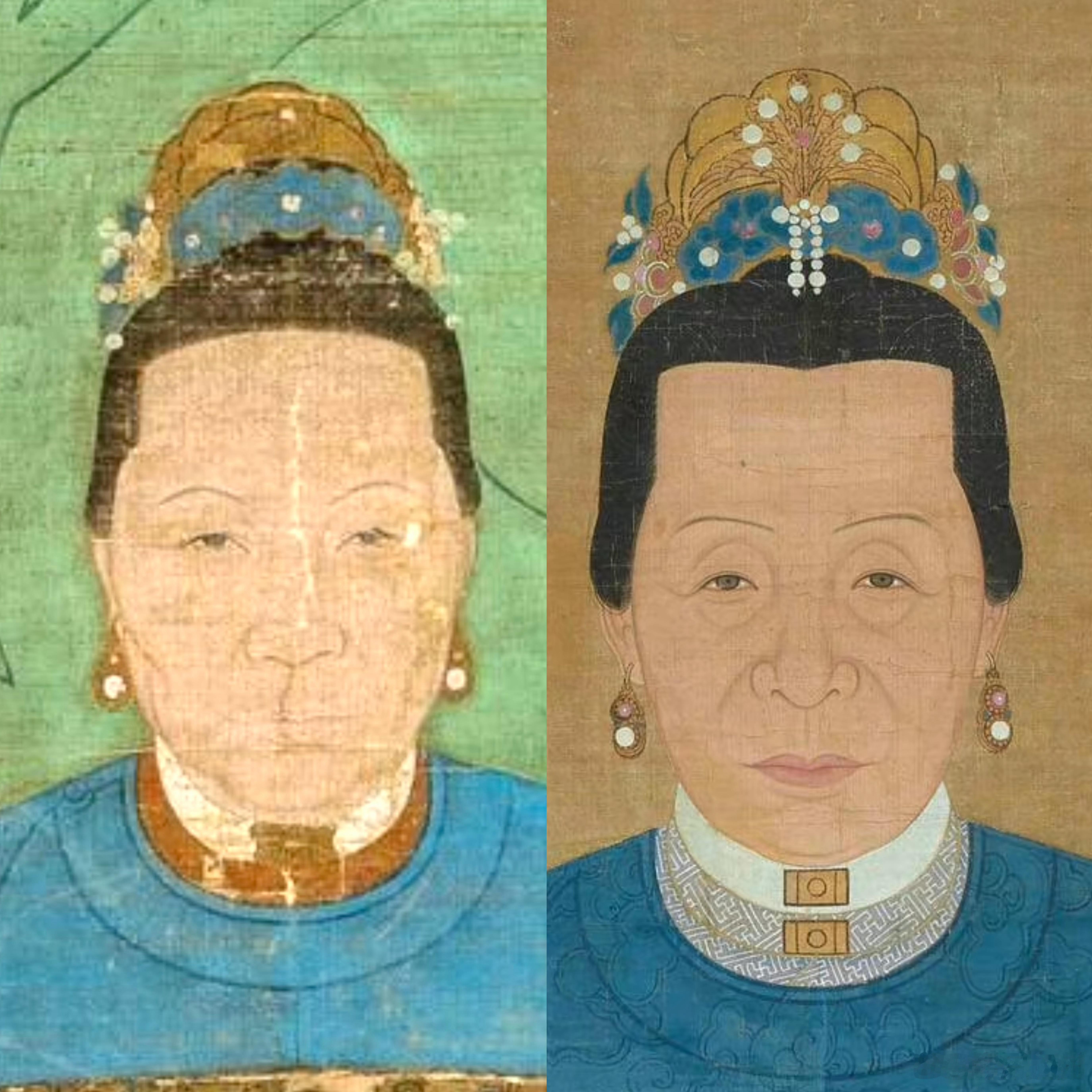 金冠的使用。​​​