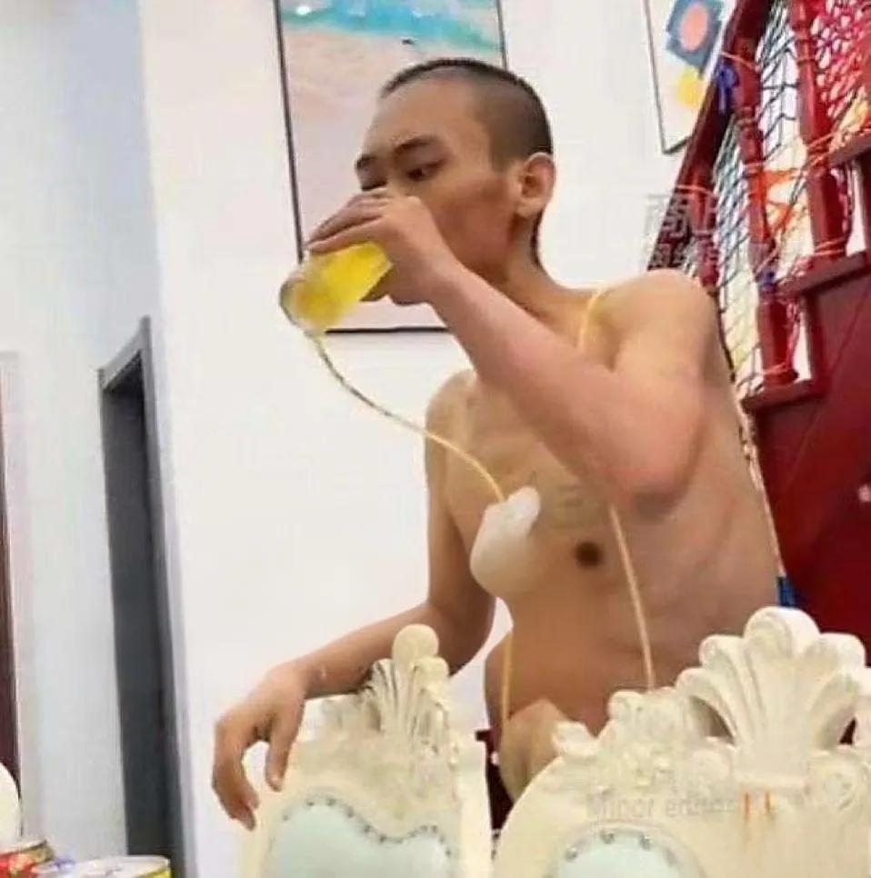 生死看淡！2020年四川一男子有个肝癌晚期，放弃治疗后买了箱啤酒。他插着管子，光