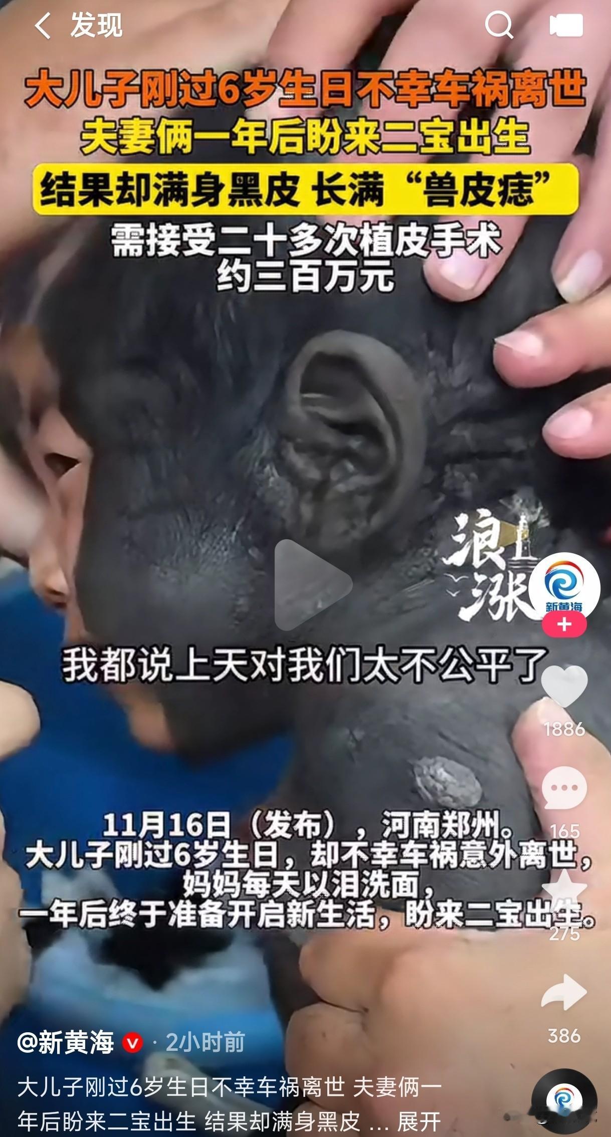 河南夫妻大儿子刚过6岁生日不幸车祸离世，夫妻俩一年后终于盼来二宝的出生，准备开启