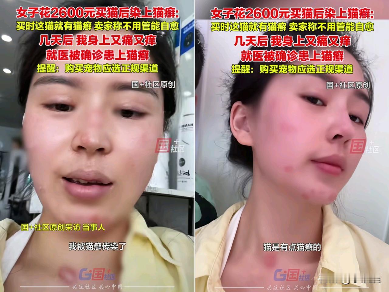 崩溃了！花2600块买只带癣的猫，结果把自己搞到不敢出门！这姑娘的事